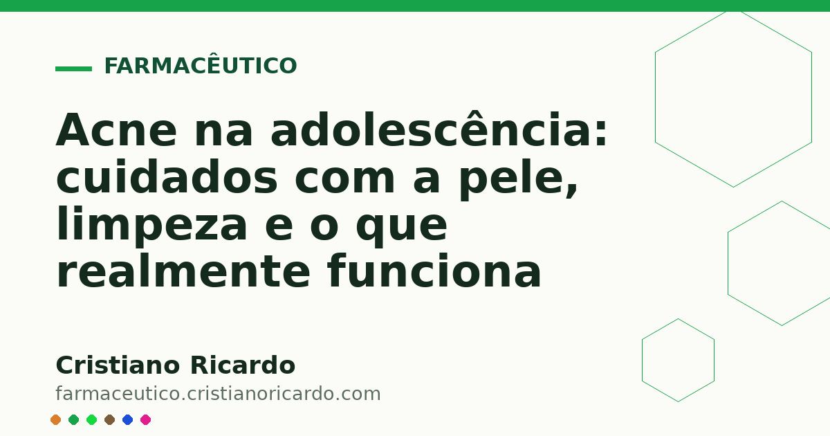 Card OG automático: Acne na adolescência: cuidados com a pele, limpeza e o que realmente funciona